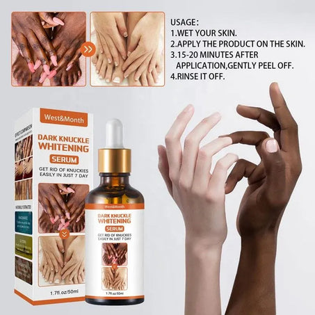 Dark Knuckles Whitening Serum – Pigmentation Corrector for Hands, Elbows, Knees & More