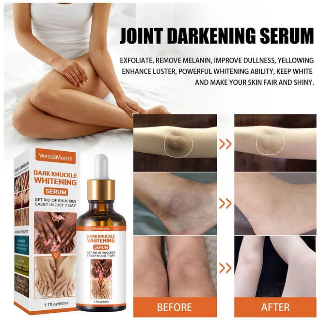 Dark Knuckles Whitening Serum – Pigmentation Corrector for Hands, Elbows, Knees & More